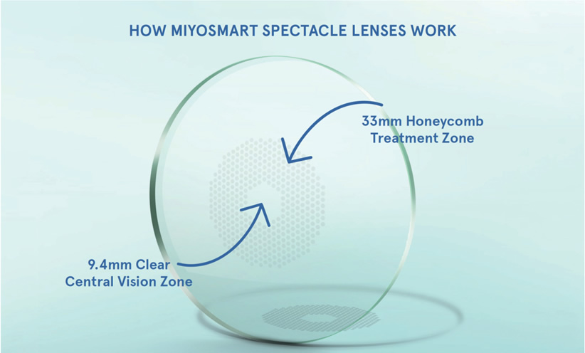 Visual of how MiYOSMART spectacle lenses work